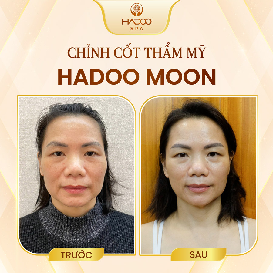 Hadoo Moon 4
